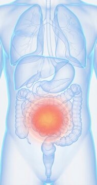 Medical illustration of human anatomy with highlighted bladder