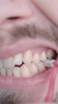 Oral hygiene with interdental brush