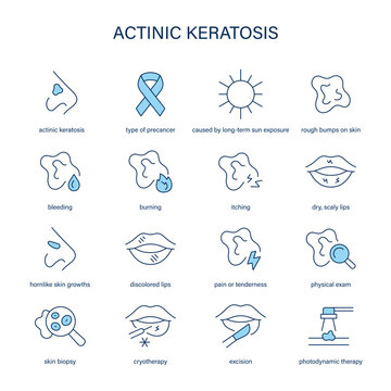 Actinic Keratosis symptoms, diagnostic and treatment vector icon set