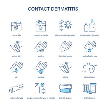 Contact Dermatitis  symptoms, diagnostic and treatment vector icon set