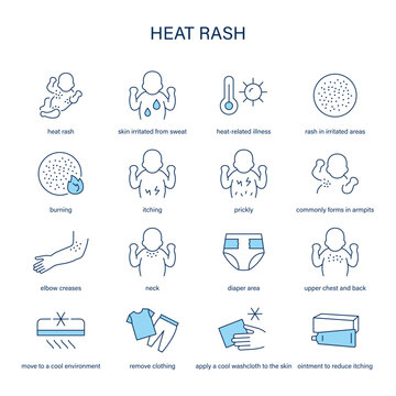 Heat Rash symptoms, diagnostic and treatment vector icon set