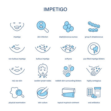 Impetigo symptoms, diagnostic and treatment vector icon set
