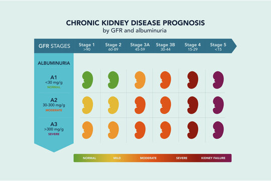 Chronic kidney disease prognosis by GFR and albuminuria medical chart