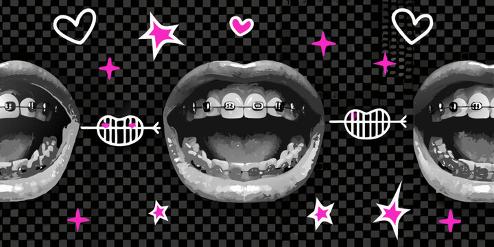 A triptych of mouths with braces adorned with pink hearts and stars