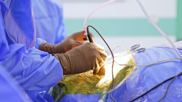 Surgeon hands using micro-instruments during neurosurgical procedure. Close-up of neurosurgeon in brown sterile gloves performing operation on patient head with surgical tools and drapes.