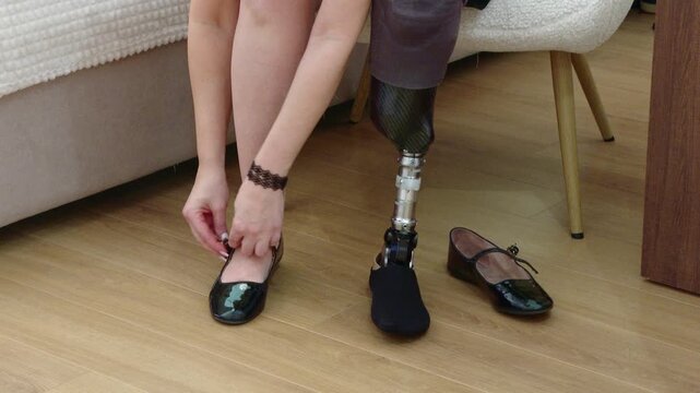 Woman with a prosthetic leg putting on her shoes
