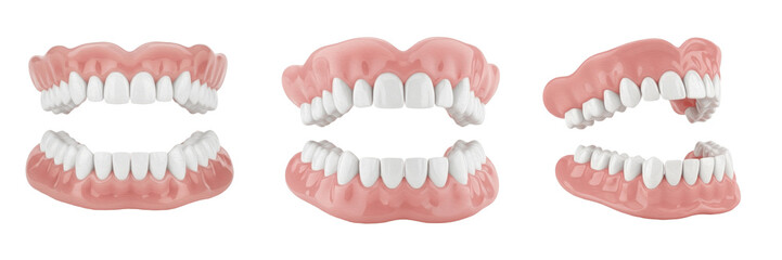 Obraz premium Denture set isolated on white background, full dentures prosthodontics close up, complete removable false teeth for upper and lower jaw replacement, dental prosthesis model used in dentistry clinic