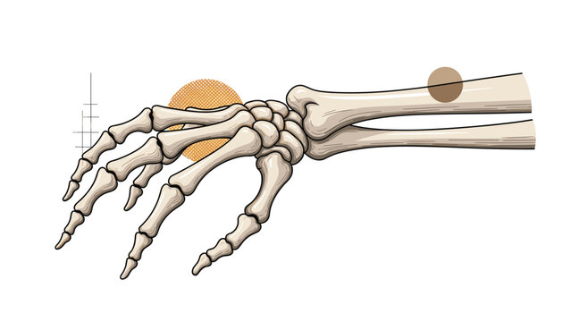 Anatomical illustration of a human hand and forearm skeleton showing the complex structure of carpal bones, metacarpals, and finger phalanges.