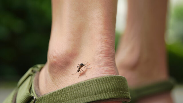 Mosquito on human ankle outdoors, aedes mosquito bite on skin, disease vector for chikungunya fever outbreak, arbovirus transmission risk in tropical climate, mosquito control prevention