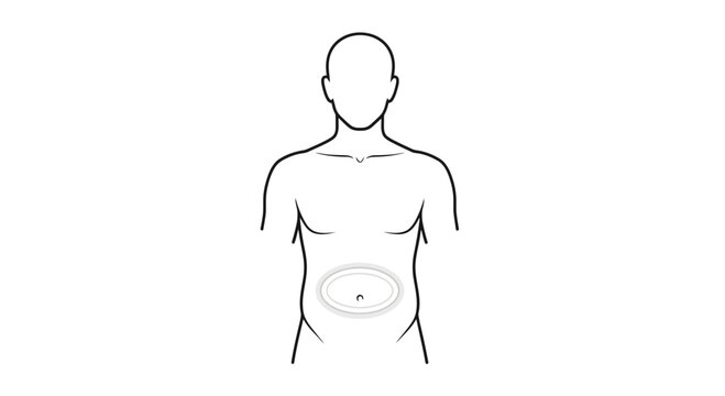 Human torso with navel highlighted, medical illustration, anatomical view