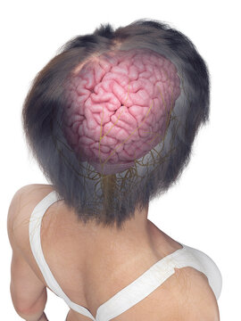 3D Anatomical Depiction Showing The Brain Of A Woman