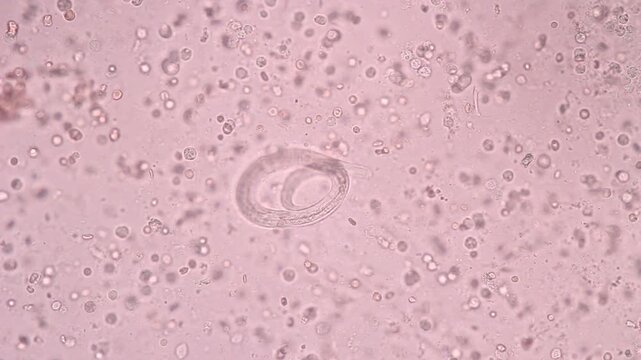 View in microscopic Strongyloides stercoralis or threadworm in human stool.Parasite or fluke infection.Medical background analyze by microscope, original magnification 400x