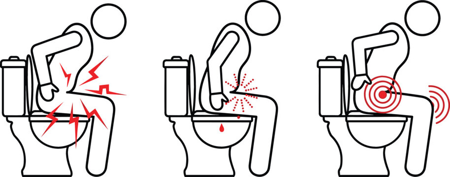 Medical vector illustration showing stick figures with rectal pain and symptoms for hemorrhoids health concept
