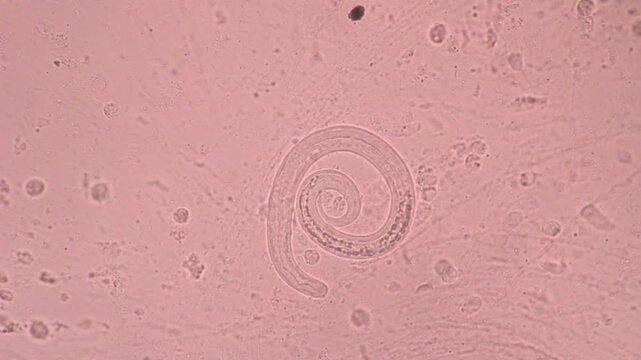 View in microscopic Strongyloides stercoralis or threadworm in human stool.Parasite or fluke infection.Medical background analyze by microscope, original magnification 400x