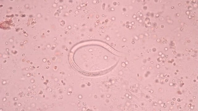 View in microscopic Strongyloides stercoralis or threadworm in human stool.Parasite or fluke infection.Medical background analyze by microscope, original magnification 400x