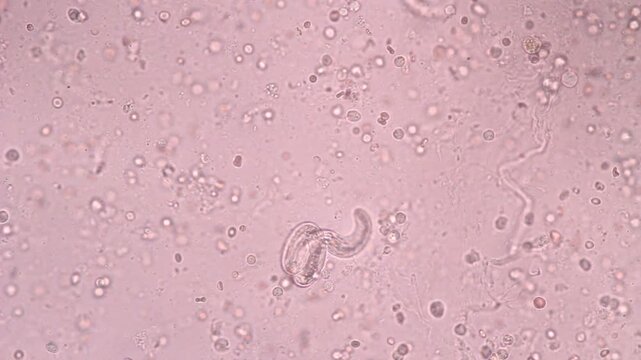 View in microscopic Strongyloides stercoralis or threadworm in human stool.Parasite or fluke infection.Medical background analyze by microscope, original magnification 400x