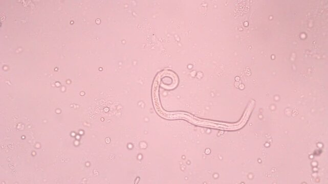 View in microscopic Strongyloides stercoralis or threadworm in human stool.Parasite or fluke infection.Medical background analyze by microscope, original magnification 400x