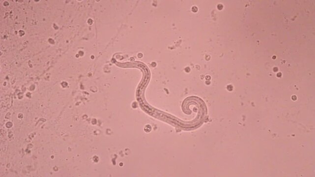 View in microscopic Strongyloides stercoralis or threadworm in human stool.Parasite or fluke infection.Medical background analyze by microscope, original magnification 400x