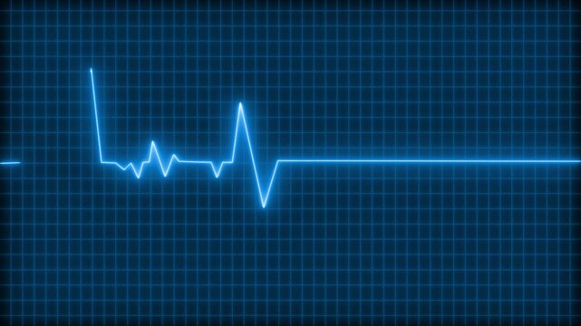 Digital heartbeat monitor showing a flatline with a brief spike animation