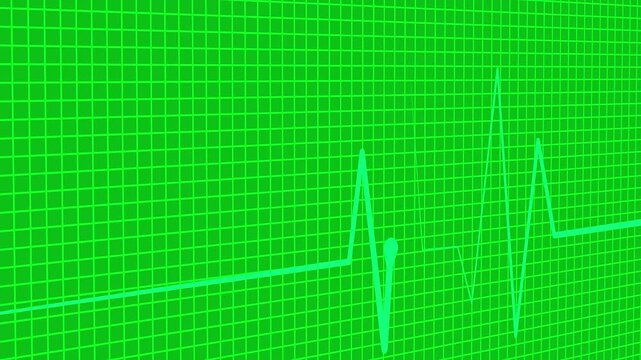 Electrocardiogram heartbeat wave signal animation on grid background
