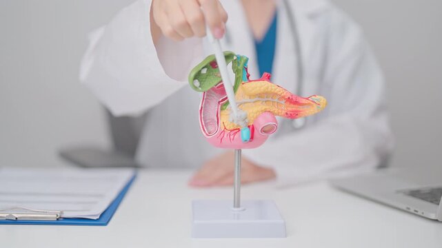 Doctor with human Pancreatitis anatomy model with Pancreas, Gallbladder, Bile Duct, Duodenum, Small intestine. Pancreatic cancer, Acute and Chronic pancreatitis, Digestive system and Health concept