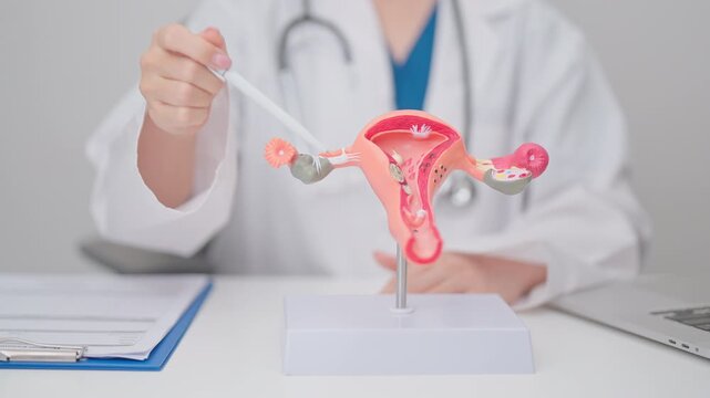 Doctor with Uterus and Ovaries anatomy model. Ovarian and Cervical cancer, Cervix disorder, Endometriosis, Hysterectomy, Uterine fibroids, Reproductive system, Pregnancy and health concept