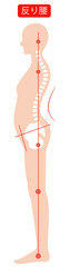 反り腰の女性　背骨と骨盤