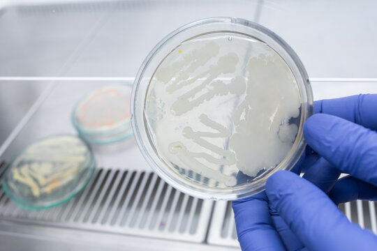 A petri dish containing dangerous bacteria isolated from a sick person in a clinic.