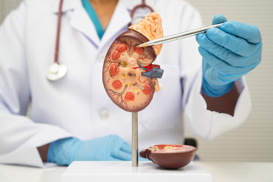 Chronic kidney disease, doctor with model for treatment urinary system, urology, Estimated glomerular filtration rate eGFR.