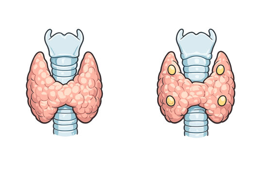 Medical illustration of the human thyroid gland and trachea. The right image shows the four parathyroid glands located on the posterior surface of the thyroid lobes against a black background.