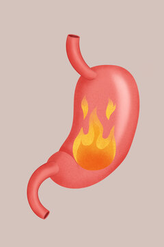 Stomach illustration with flames indicating heartburn