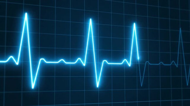 Electrocardiogram graph displaying heartbeat rhythm on digital screen with grid pattern in medical monitoring environment