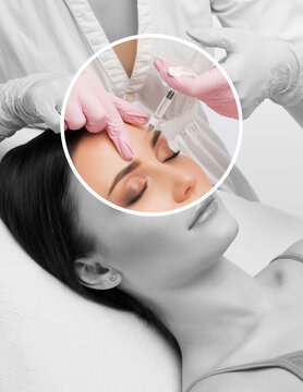 Cosmetologist does injections for lips augmentation and anti wrinkle in the nasolabial folds of a beautiful woman. Women's cosmetology in the beauty salon.