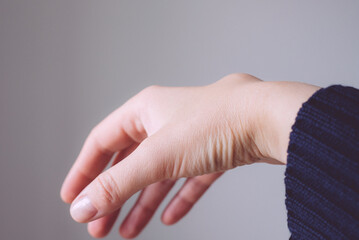 Female right back hand with ganglion cyst on the dorsum,  fluid-filled bump associated with a joint or tendon sheath, close-up view, selected focus.
