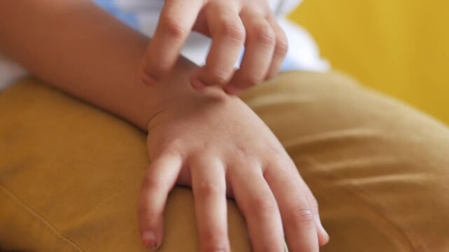 Close-up of child scratching arm due to itch, slow motion footage showing discomfort and skin irritation