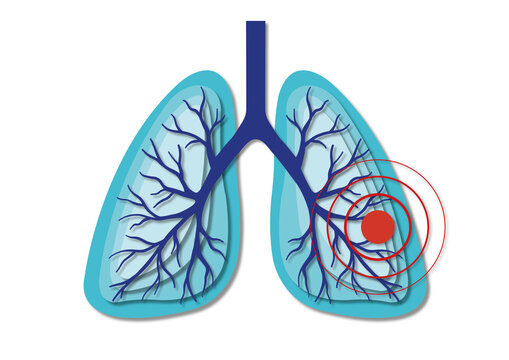 Lung pain, conceptual illustration