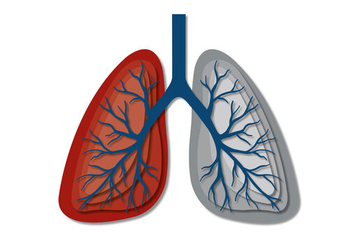 Tuberculosis, conceptual illustration