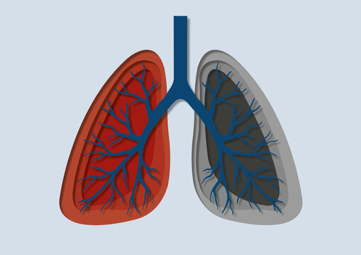 Tuberculosis, conceptual illustration