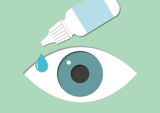 Eye drop application, illustration