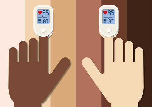 Pulse oximeters clipped on fingers, illustration
