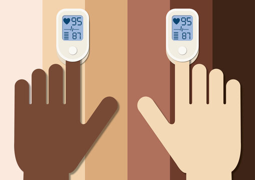 Pulse oximeters clipped on fingers, illustration
