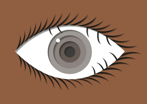Trichiasis, illustration