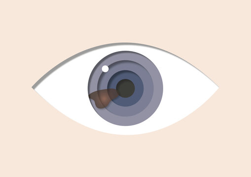 Eye cancer, illustration