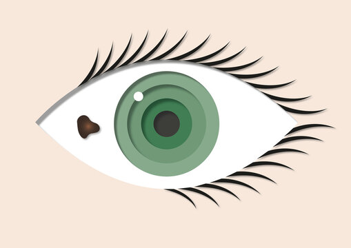 Conjunctival melanoma, illustration