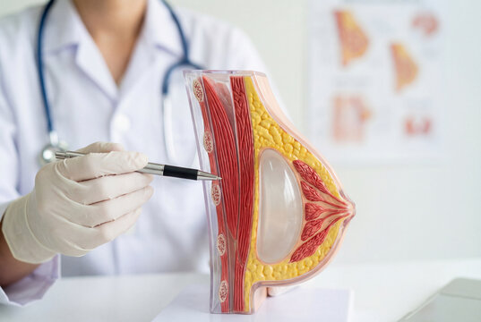 Doctor hands pointing at anatomical model of female breast during plastic surgery consultation