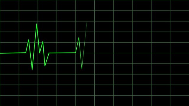 Green heartbeat pulse line moving across a dark medical monitor grid ecg ekg cardiac rhythm health