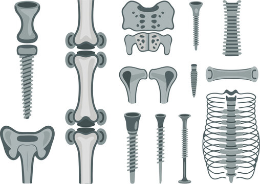 Set of orthopedic bone screws and plates Vector isolated on transparent bg