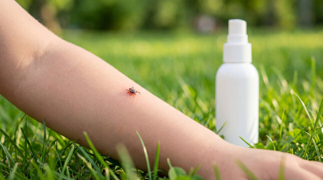 Dangerous parasitic tick insect crawling on skin of little child arm lying on green grass outdoors near white repellent spray bottle for protection