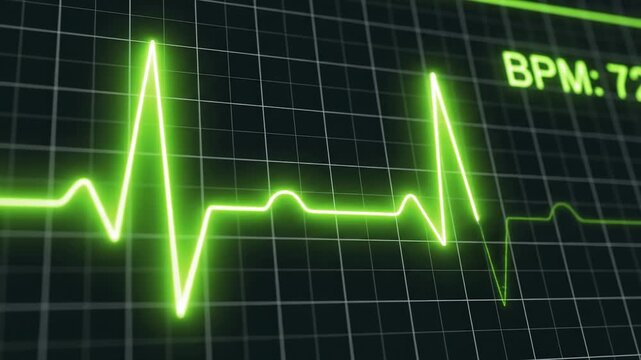 Green EKG Heartbeat Monitor Displaying BPM 72 With Grid Background Medical Technology Concept