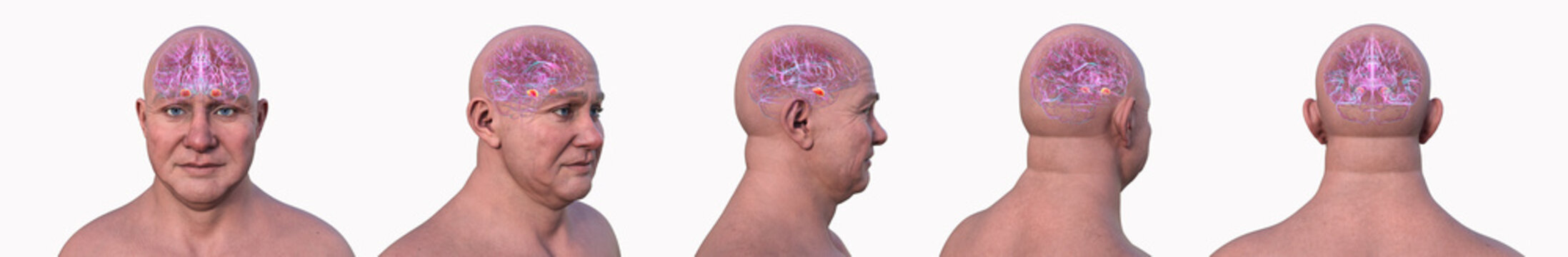 Amygdala, 3D illustration